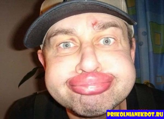 Губки бантиком, бровки домиком- это Шурику врезали ломиком!.Прикольные картинки. Фото приколы на сайте prikolnianekdot.ru